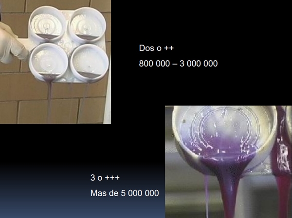 Pruebas para el diagnóstico de la mastitis bovina - Image 15