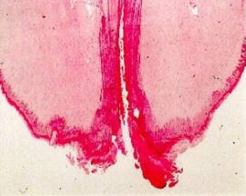 La Mastitis un problema del hato la visita al establo. - Image 17