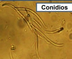 Aparición en Pergamino (Buenos Aires) de septoriosis en trigo - Image 3
