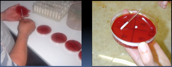 Pruebas para el diagnóstico de la mastitis bovina - Image 23