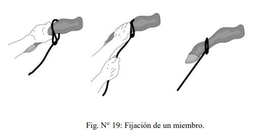Obstetricia y neonatología bovina: VIII. Instrumental de obstetricia - Image 3