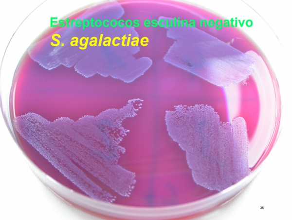 Mastitis - Introduccion, los factores que influyen en la salud de la ubre. - Image 24