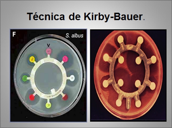 Importancia de los cultivos bacteriológicos en el diagnóstico de la mastitis bovina y antibiograma - Image 18