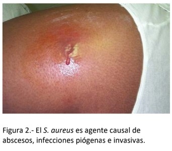 Detección de genes de resistencia a antibióticos en Staphylococcus aureus aislados de casos de mastitis bovina. - Image 3
