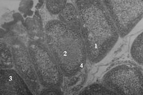 Estudio comparativo de tres cepas vacunales del virus causante de la enfermedad de la bursa en pollos de engorde - Image 4