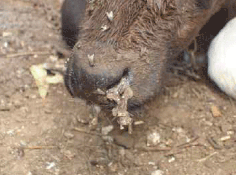 onfaloflebitis