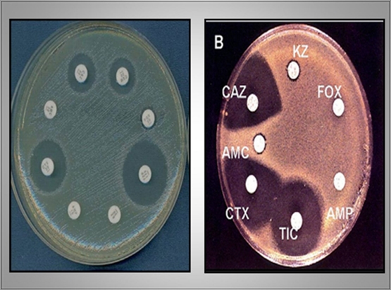 Importancia de los cultivos bacteriológicos en el diagnóstico de la mastitis bovina y antibiograma - Image 19