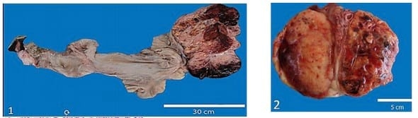 Tumor de células de la granulosa maligno en una vaca holstein. - Image 1