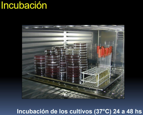 Pruebas para el diagnóstico de la mastitis bovina - Image 24