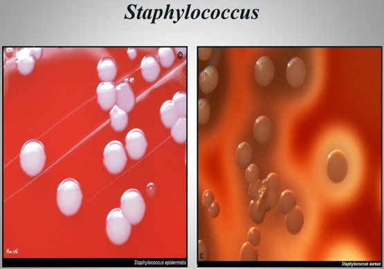 Importancia de los cultivos bacteriológicos en el diagnóstico de la mastitis bovina y antibiograma - Image 8