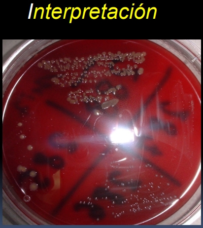 Pruebas para el diagnóstico de la mastitis bovina - Image 25