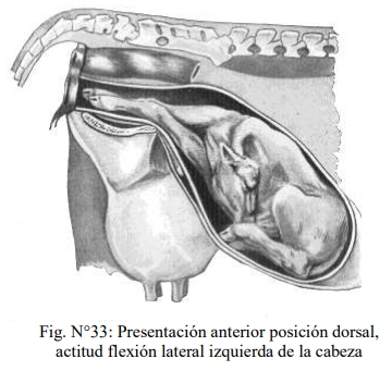 Obstetricia y neonatología bovina: XI. Estática fetal Anormal - Image 1