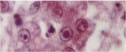 Características fisiológicas del hígado de ave | Se adjuntan tres tipos de enfermedad hepática difíciles de diagnosticar. - Image 5