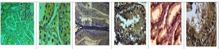 Estudio comparativo de tres cepas vacunales del virus causante de la enfermedad de la bursa en pollos de engorde - Image 2