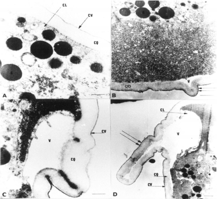 Aislamiento y determinación de cepas bacterianas con actividad nematicida. Mecanismo de acción de C. paurometabolum C-924 sobre nemátodos - Image 3