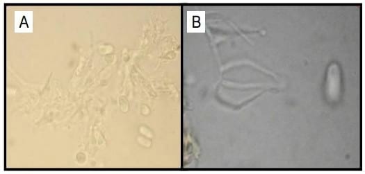 Detección de Ergot (claviceps africana) en semilla de sorgo comerciales. - Image 3