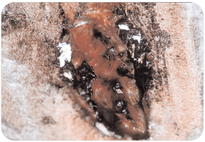 Mosca de las bicheras (Cochliomyia hominivorax) (biología, importancia económica, aspectos epidemiológicos y tendencias estacionales en el área central de la Argentina, control) - Image 2