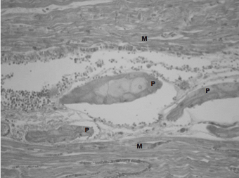 Caso clínico: Brote de enfermedad del músculo blanco o miodegeneración nutricional en terneros - Image 4