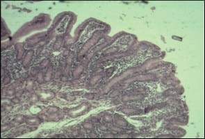 Uso de comederos de apoyos para lechones en las primeras semanas posterior al destete y su impacto en el desempeño productivo - Image 1