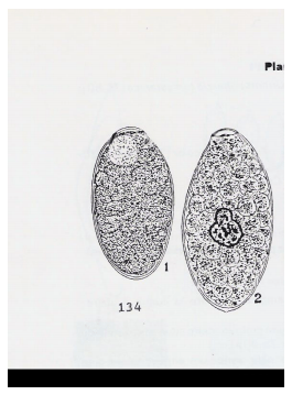 Diagnostico diferencial ante mortem entre Fasciola hepatica y Cotylophoron spp - Image 11