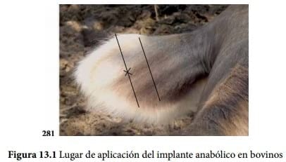 Implantes - Image 1