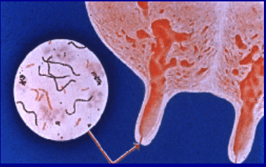 Diagnóstico de mastitis en un tambo problema - Image 1