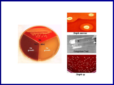 Diagnóstico de mastitis en un tambo problema - Image 36
