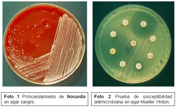 Mastitis por Nocardia asteroides en vacas Holstein-Friesian de la cuenca lechera de Tizayuca, Hidalgo, México - Image 4