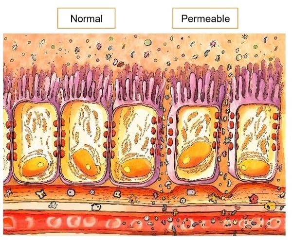 “Síndrome de Intestino Permeable”: la historia detrás de un mal desempeño - Image 1