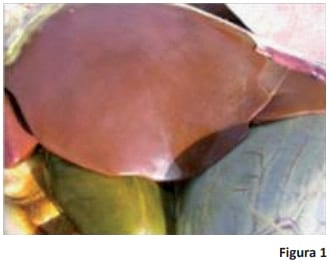 Prevención, diagnóstico y tratamiento de babesiosis y anaplasmosis - Image 1