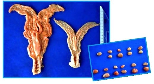 Gastroenteritis verminosa de los rumiantes. Parte 1 - Image 19