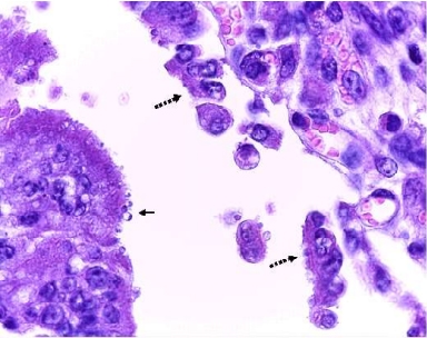 Brote de Alta Mortalidad en Terneros Lecheros por Diarrea Neonatal Producida por Cryptosporidium sp Asociado a Bacteriemia en un Establo Lechero de Lima - Image 3