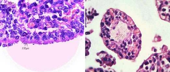 Brote de Alta Mortalidad en Terneros Lecheros por Diarrea Neonatal Producida por Cryptosporidium sp Asociado a Bacteriemia en un Establo Lechero de Lima - Image 2