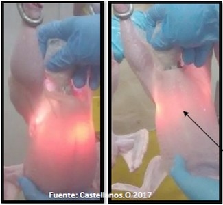 Técnica para la detección de miopatía de pectoral profundo en planta de beneficio (Pechulumenoscopía). - Image 3