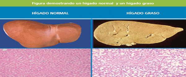 Silimarina: Una arma eficaz contra los desafíos infecciosos y metabólicos - Image 3