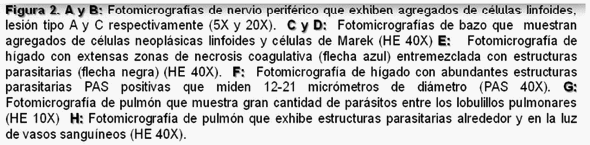 Una nueva asociación: histomoniasis sistémica ocasionada por enfermedad de marek - Image 4