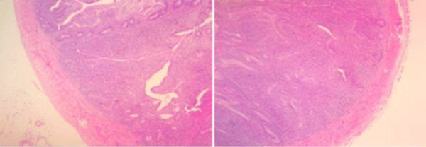 Evaluación de la respuesta inmunológica de los ß-glucanos 1,3/1,6; Nucleótidos mRNA y Pared de levadura, en pollos de engorde con un protocolo de 1-21 días en uso continuo - Image 7