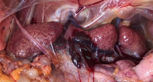 Reducción de los efectos tóxicos de los alimentos, mediante la utilización de los Adsorbentes de Micotoxinas - Revisión - Image 5