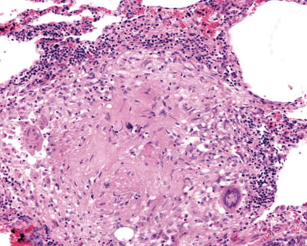 ¿Inflamarse o no inflamarse? Esa es la cuestión. Una actualización sobre las bases inmunológicas de la inflamación y su impacto en la salud animal - Parte 2 - Image 4