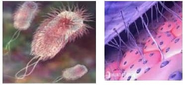 Diarrea Neonatal por Escherichia Coli - Image 2