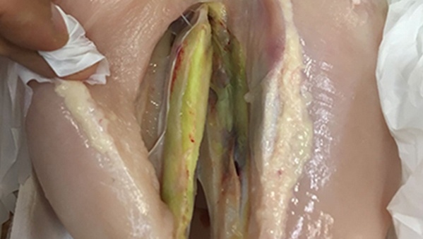 Principales miopatías que afectan la calidad de carcasa en broilers - Image 5