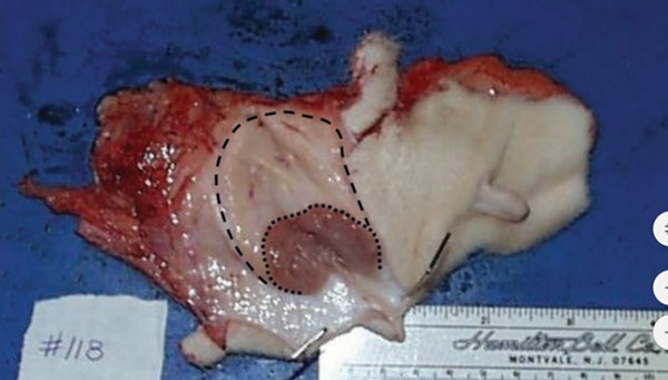 No deje a sus becerras con hambre de leche o sustituto de leche: Piense en que se está manufacturando la ubre del futuro. - Image 1