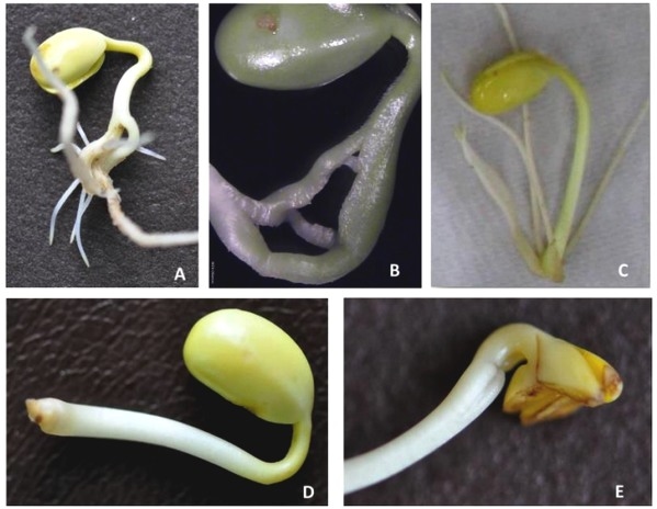 Semillas secas de soja: ¿cómo afecta su presencia en la calidad? - Image 1