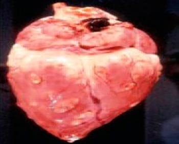 Cysticercus Cellulosae en carne de cerdos, Técnicas para eliminarlo - Image 18