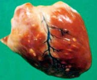Cysticercus Cellulosae en carne de cerdos, Técnicas para eliminarlo - Image 20