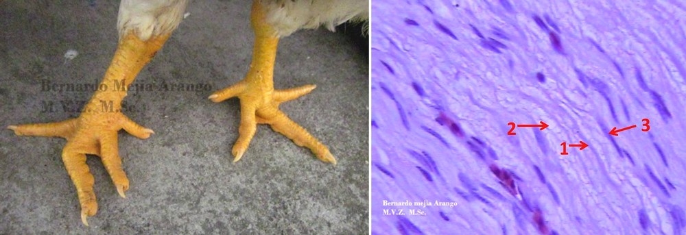 Arriboflavinosis. Presentación de casos. - Image 1
