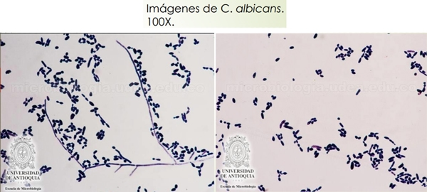 Género Candida. - Image 3