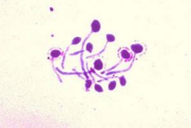 Género Candida. - Image 7