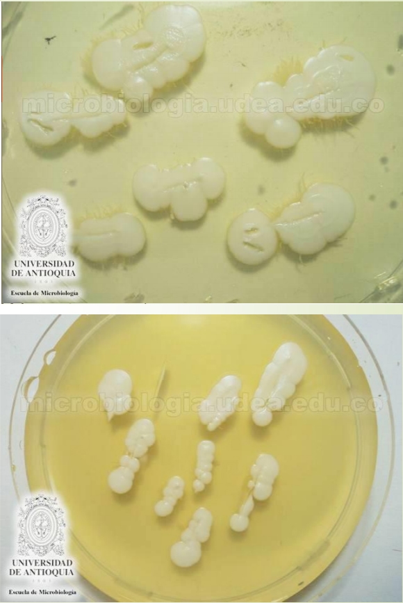 Género Candida. - Image 6