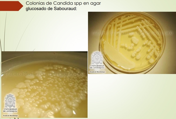 Género Candida. - Image 5